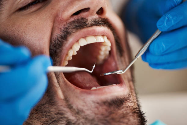 Professional Emergency Dentist in NC