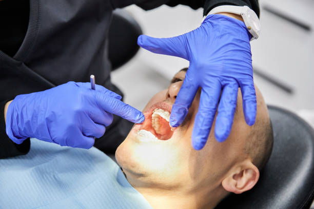 Best Emergency Tooth Extraction in Belwood, NC